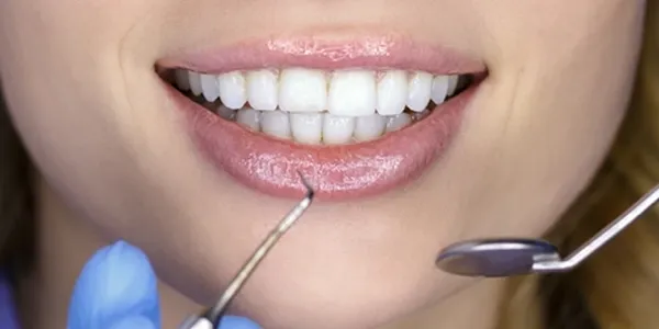 Dental check-up depiction in a bright, high-contrast setting.